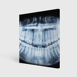 Холст квадратный Зубной Рентген, цвет: 3D-принт