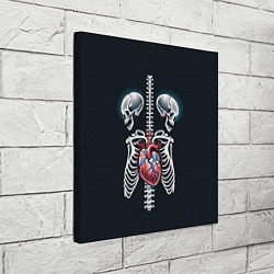 Холст квадратный Два сросшихся скелета и сердце, цвет: 3D-принт — фото 2