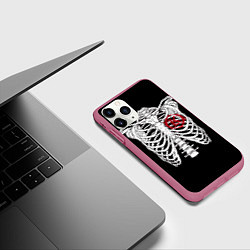 Чехол iPhone 11 Pro матовый Кукрыниксы: Скелет, цвет: 3D-малиновый — фото 2