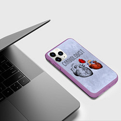 Чехол iPhone 11 Pro матовый Cardiologist, цвет: 3D-фиолетовый — фото 2