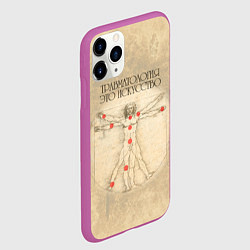 Чехол iPhone 11 Pro матовый Травматология как искусство, цвет: 3D-фиолетовый — фото 2