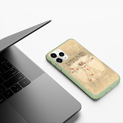 Чехол iPhone 11 Pro матовый Травматология как искусство, цвет: 3D-салатовый — фото 2