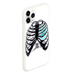 Чехол iPhone 11 Pro матовый X-Ray, цвет: 3D-белый — фото 2