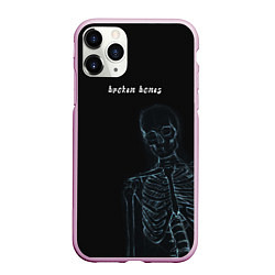 Чехол iPhone 11 Pro матовый Broken bones