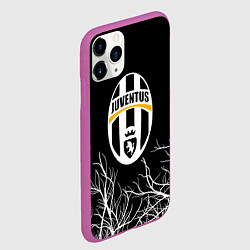Чехол iPhone 11 Pro матовый Ювентус деревья белые, цвет: 3D-фиолетовый — фото 2