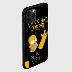 Чехол для iPhone 12 Pro Max Cannibal Corpse Симпсоны Гомер рокер, цвет: 3D-черный — фото 2