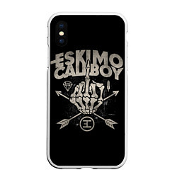 Чехол iPhone XS Max матовый Eskimo Callboy: Bones, цвет: 3D-белый