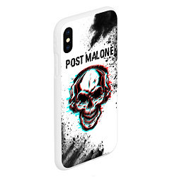 Чехол iPhone XS Max матовый Post Malone - ЧЕРЕП - Арт, цвет: 3D-белый — фото 2