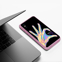 Чехол iPhone XS Max матовый Сердечко левой рукой - неоновый рентген, цвет: 3D-розовый — фото 2