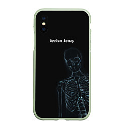 Чехол iPhone XS Max матовый Broken bones