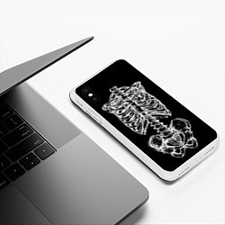 Чехол iPhone XS Max матовый Скелет, цвет: 3D-белый — фото 2